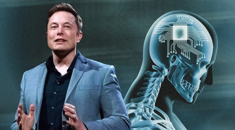 Gila! Elon Musk Bakal Tanam Chip Otak Lagi Minggu Depan!